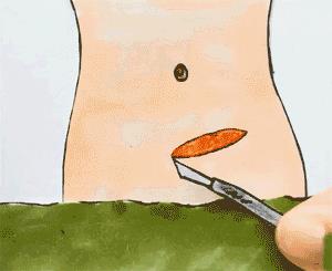 剖腹产后坐月子10条小建议,第8条如果不注意,受伤的是自己