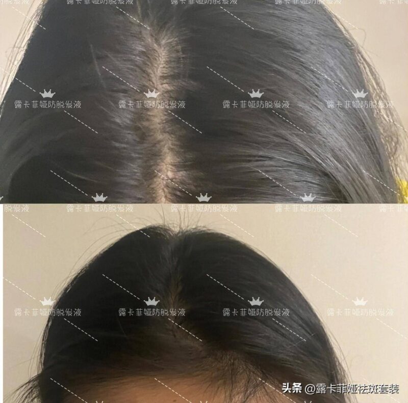 洗发水品牌排行榜前十名不掉头发-1