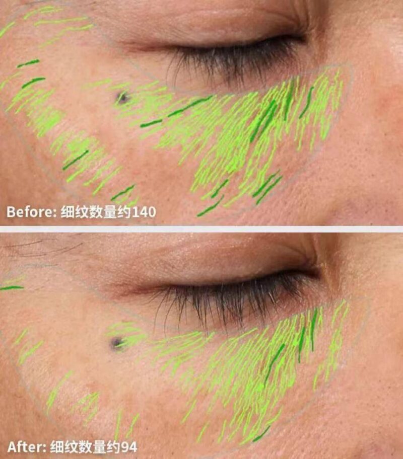 40岁女人护肤品排行榜(适合40-50岁女人的护肤品)-1 40岁女人护肤品排行榜(适合40-50岁女人的护肤品)-1